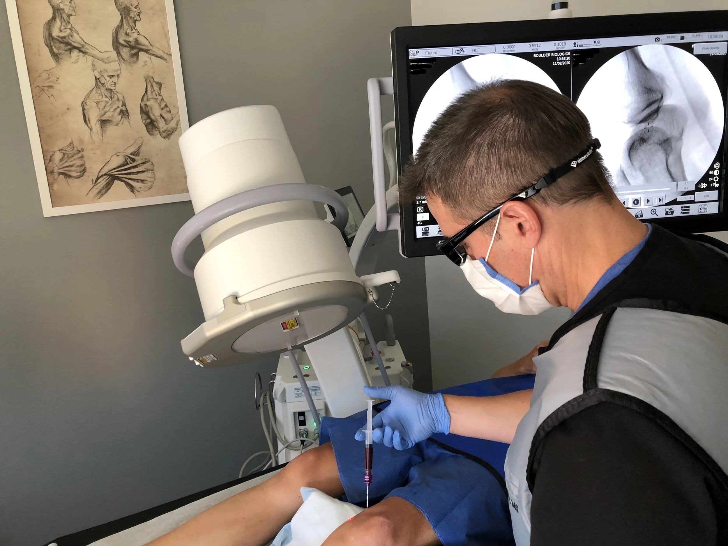 A physician performs a fluoroscopy-guided autologous biologic injection at Boulder Biologics